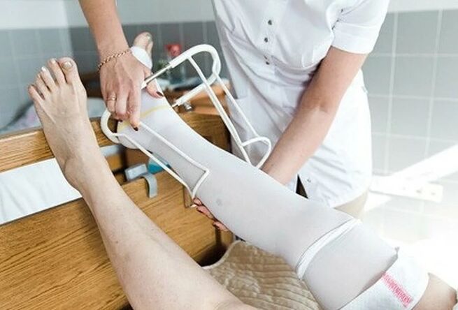 Pooperacinis laikotarpis nuo kojų venų operacijos