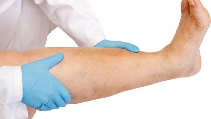 kaip atpažinti ligą